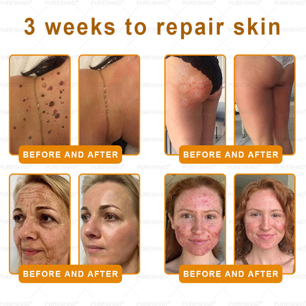 𝐌𝐚𝐝𝐞 𝐚𝐧𝐝 𝐒𝐡𝐢𝐩𝐩𝐞𝐝 𝐟𝐫𝐨𝐦 𝐔𝐒𝐀 ✨✨𝗣𝘂𝗿𝗲𝐒𝐡𝐚𝐝𝐞® 𝐍𝐞𝐜𝐤 & 𝐂𝐡𝐞𝐬𝐭 𝐅𝐢𝐫𝐦𝐢𝐧𝐠 𝐀𝐠𝐞 𝐑𝐞𝐧𝐞𝐰 𝐂𝐫𝐞𝐚𝐦