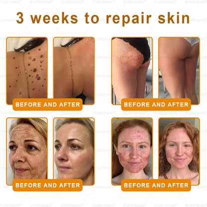 𝐌𝐚𝐝𝐞 𝐚𝐧𝐝 𝐒𝐡𝐢𝐩𝐩𝐞𝐝 𝐟𝐫𝐨𝐦 𝐔𝐒𝐀 ✨✨𝗣𝘂𝗿𝗲𝐒𝐡𝐚𝐝𝐞® 𝐍𝐞𝐜𝐤 & 𝐂𝐡𝐞𝐬𝐭 𝐅𝐢𝐫𝐦𝐢𝐧𝐠 𝐀𝐠𝐞 𝐑𝐞𝐧𝐞𝐰 𝐂𝐫𝐞𝐚𝐦