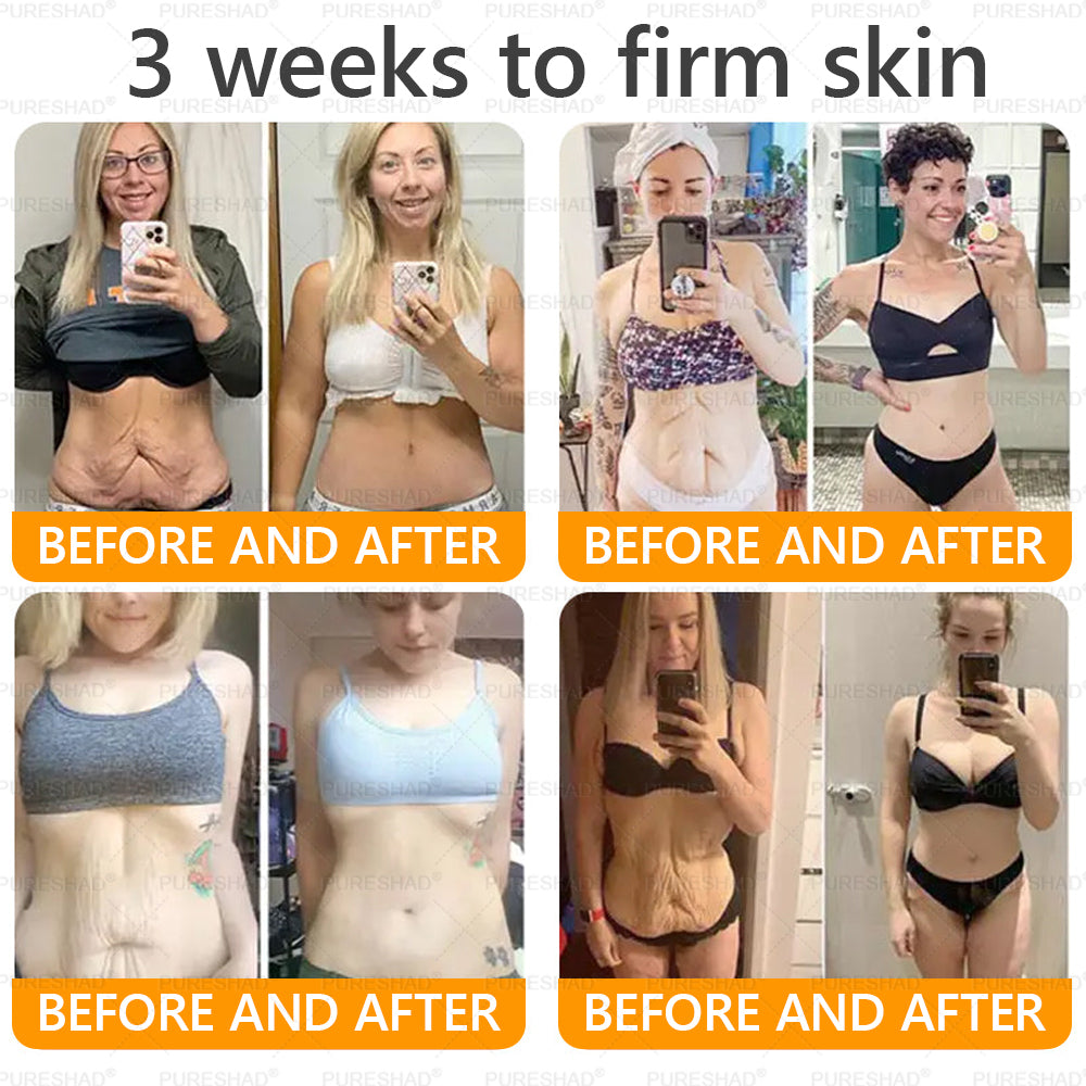 𝐌𝐚𝐝𝐞 𝐚𝐧𝐝 𝐒𝐡𝐢𝐩𝐩𝐞𝐝 𝐟𝐫𝐨𝐦 𝐔𝐒𝐀 ✨✨𝗣𝘂𝗿𝗲𝐒𝐡𝐚𝐝𝐞® 𝐍𝐞𝐜𝐤 & 𝐂𝐡𝐞𝐬𝐭 𝐅𝐢𝐫𝐦𝐢𝐧𝐠 𝐀𝐠𝐞 𝐑𝐞𝐧𝐞𝐰 𝐂𝐫𝐞𝐚𝐦