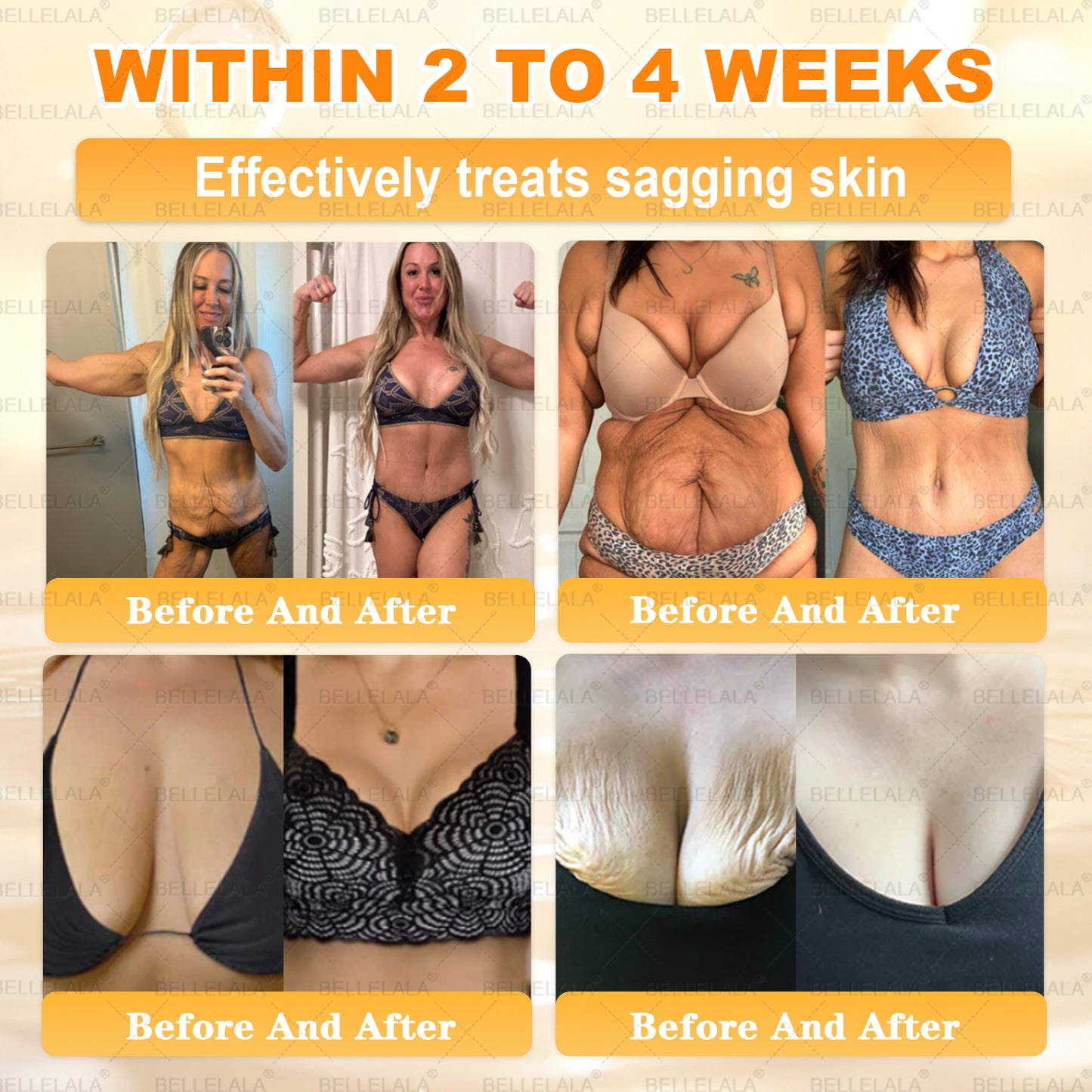 NEW & IMPROVED ✨𝐁𝐞𝐥𝐥𝐞𝐥𝐚𝐥𝐚® 𝐁𝐞𝐞 𝐯𝐞𝐧𝐨𝐦 𝐒𝐤𝐢𝐧 𝐑𝐞𝐬𝐭𝐨𝐫𝐚𝐭𝐢𝐨𝐧 𝐂𝐫𝐞𝐚𝐦