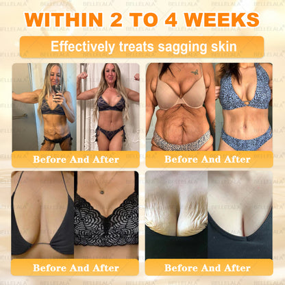 NEW & IMPROVED ✨𝐁𝐞𝐥𝐥𝐞𝐥𝐚𝐥𝐚® 𝐁𝐞𝐞 𝐯𝐞𝐧𝐨𝐦 𝐒𝐤𝐢𝐧 𝐑𝐞𝐬𝐭𝐨𝐫𝐚𝐭𝐢𝐨𝐧 𝐂𝐫𝐞𝐚𝐦