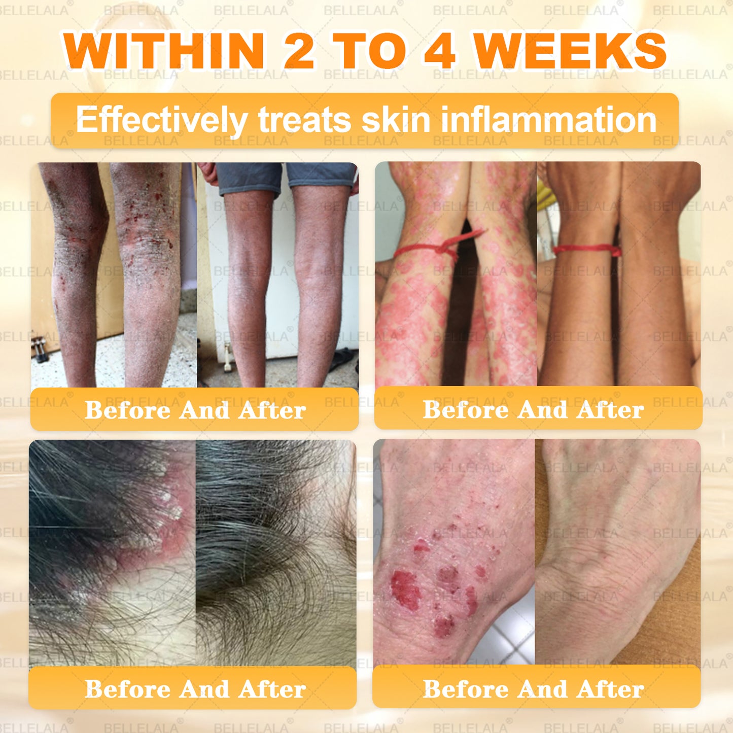 NEW & IMPROVED ✨𝐁𝐞𝐥𝐥𝐞𝐥𝐚𝐥𝐚® 𝐁𝐞𝐞 𝐯𝐞𝐧𝐨𝐦 𝐒𝐤𝐢𝐧 𝐑𝐞𝐬𝐭𝐨𝐫𝐚𝐭𝐢𝐨𝐧 𝐂𝐫𝐞𝐚𝐦
