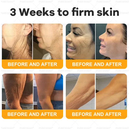 𝐌𝐚𝐝𝐞 𝐚𝐧𝐝 𝐒𝐡𝐢𝐩𝐩𝐞𝐝 𝐟𝐫𝐨𝐦 𝐔𝐒𝐀 ✨✨𝗣𝘂𝗿𝗲𝐒𝐡𝐚𝐝𝐞® 𝐍𝐞𝐜𝐤 & 𝐂𝐡𝐞𝐬𝐭 𝐅𝐢𝐫𝐦𝐢𝐧𝐠 𝐀𝐠𝐞 𝐑𝐞𝐧𝐞𝐰 𝐂𝐫𝐞𝐚𝐦