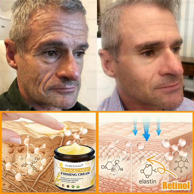 𝐌𝐚𝐝𝐞 𝐚𝐧𝐝 𝐒𝐡𝐢𝐩𝐩𝐞𝐝 𝐟𝐫𝐨𝐦 𝐔𝐒𝐀 ✨✨𝗣𝘂𝗿𝗲𝐒𝐡𝐚𝐝𝐞® 𝐍𝐞𝐜𝐤 & 𝐂𝐡𝐞𝐬𝐭 𝐅𝐢𝐫𝐦𝐢𝐧𝐠 𝐀𝐠𝐞 𝐑𝐞𝐧𝐞𝐰 𝐂𝐫𝐞𝐚𝐦