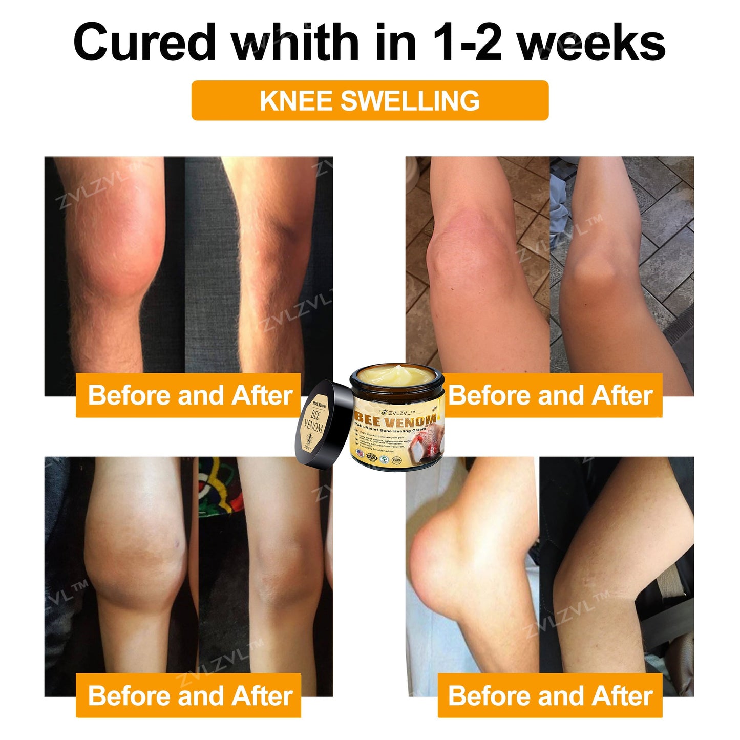 ZVLZVL™ Bee Venom Instant Pain Relief Arthritis Therapy Cream