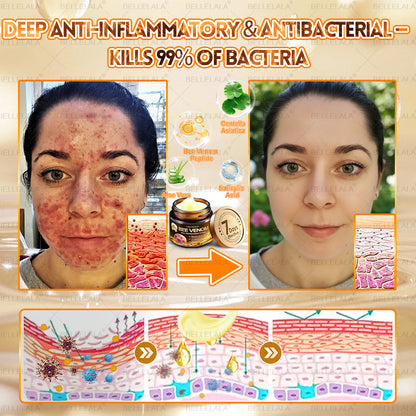 NEW & IMPROVED ✨𝐁𝐞𝐥𝐥𝐞𝐥𝐚𝐥𝐚® 𝐁𝐞𝐞 𝐯𝐞𝐧𝐨𝐦 𝐒𝐤𝐢𝐧 𝐑𝐞𝐬𝐭𝐨𝐫𝐚𝐭𝐢𝐨𝐧 𝐂𝐫𝐞𝐚𝐦