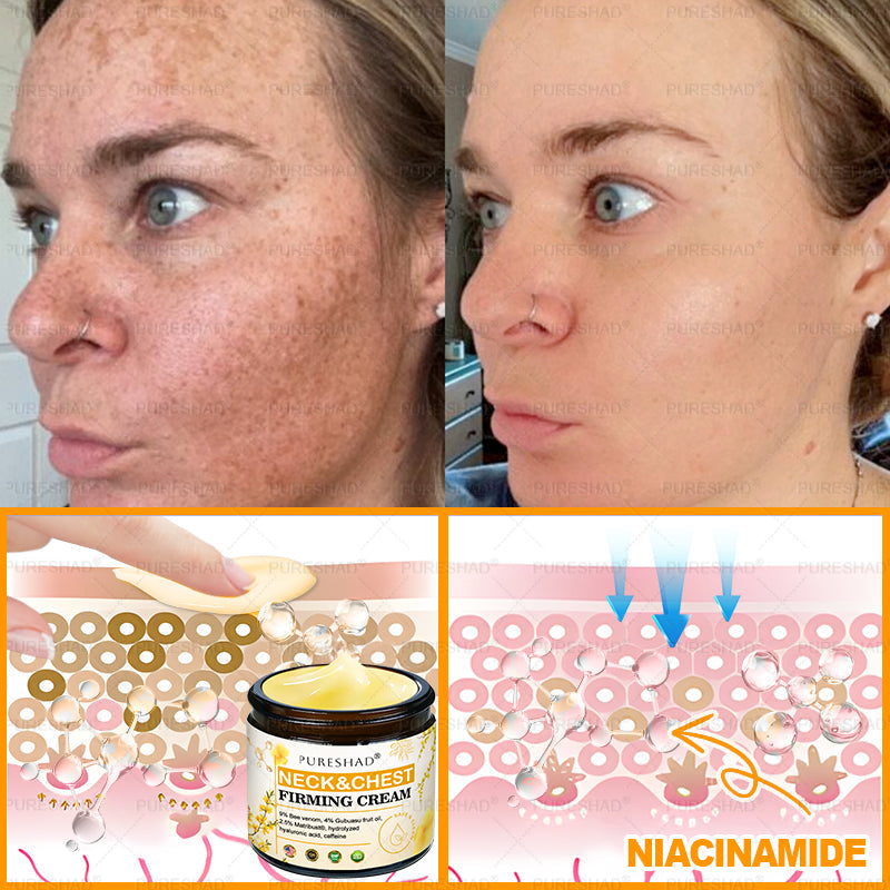 𝐌𝐚𝐝𝐞 𝐚𝐧𝐝 𝐒𝐡𝐢𝐩𝐩𝐞𝐝 𝐟𝐫𝐨𝐦 𝐔𝐒𝐀 ✨✨𝗣𝘂𝗿𝗲𝐒𝐡𝐚𝐝𝐞® 𝐍𝐞𝐜𝐤 & 𝐂𝐡𝐞𝐬𝐭 𝐅𝐢𝐫𝐦𝐢𝐧𝐠 𝐀𝐠𝐞 𝐑𝐞𝐧𝐞𝐰 𝐂𝐫𝐞𝐚𝐦