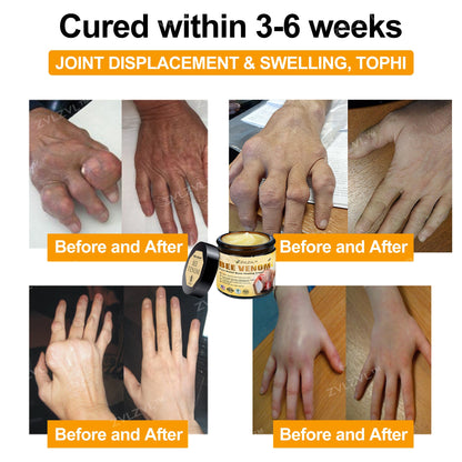 ZVLZVL™ Bee Venom Instant Pain Relief Arthritis Therapy Cream