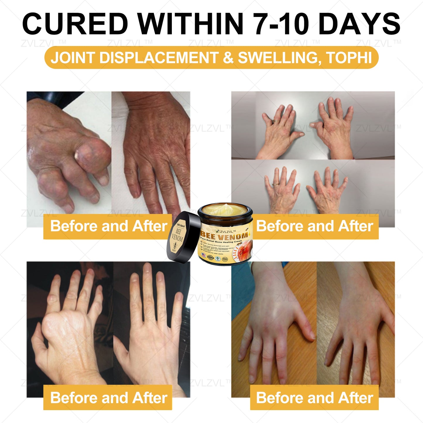ZVLZVL™ Bee Venom Instant Pain Relief Arthritis Therapy Cream