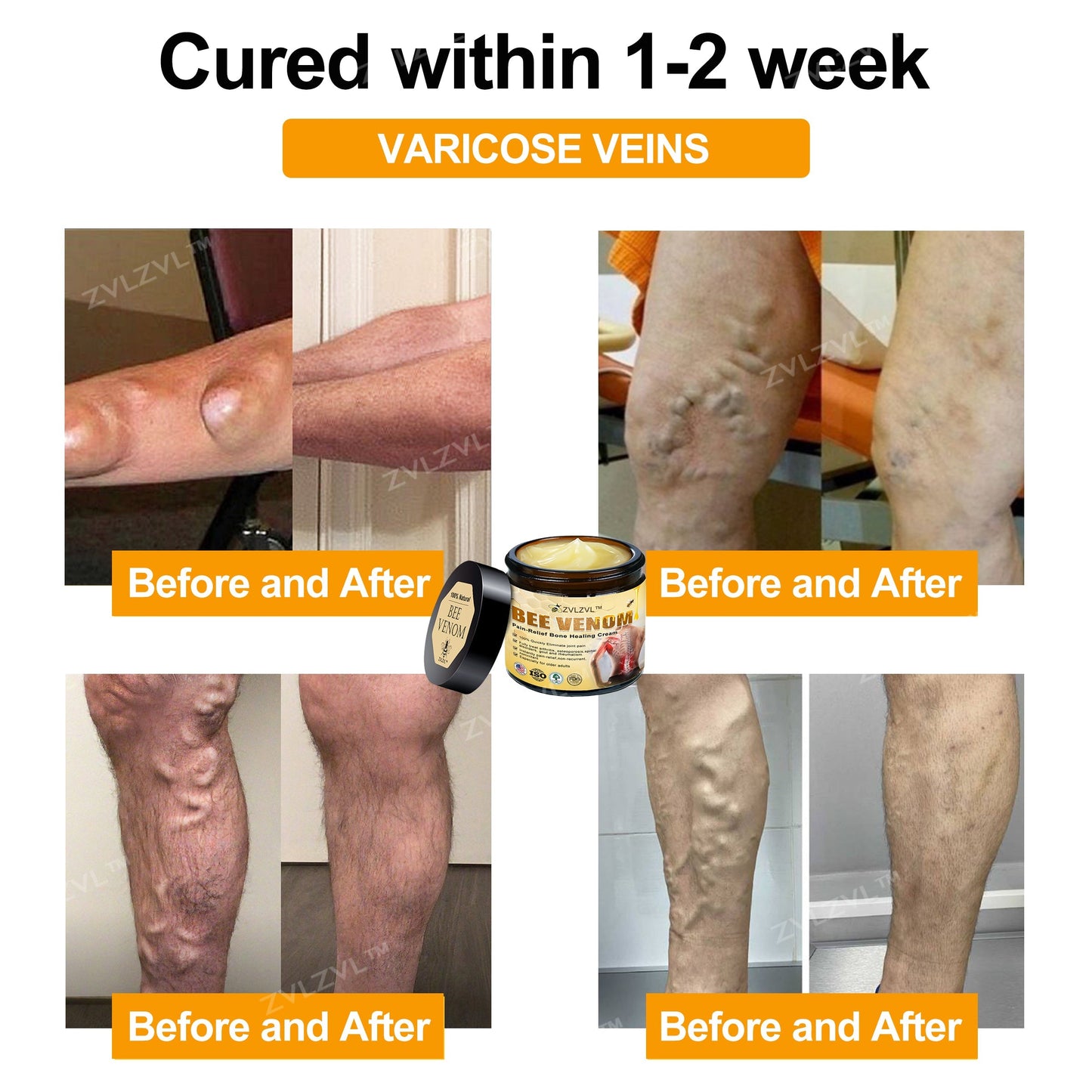 ZVLZVL™ Bee Venom Instant Pain Relief Arthritis Therapy Cream