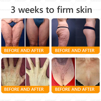 𝐌𝐚𝐝𝐞 𝐚𝐧𝐝 𝐒𝐡𝐢𝐩𝐩𝐞𝐝 𝐟𝐫𝐨𝐦 𝐔𝐒𝐀 ✨✨𝗣𝘂𝗿𝗲𝐒𝐡𝐚𝐝𝐞® 𝐍𝐞𝐜𝐤 & 𝐂𝐡𝐞𝐬𝐭 𝐅𝐢𝐫𝐦𝐢𝐧𝐠 𝐀𝐠𝐞 𝐑𝐞𝐧𝐞𝐰 𝐂𝐫𝐞𝐚𝐦